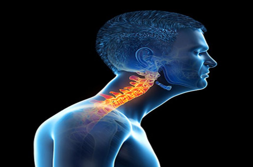 A postura de pescoço para a frente provoca dores?